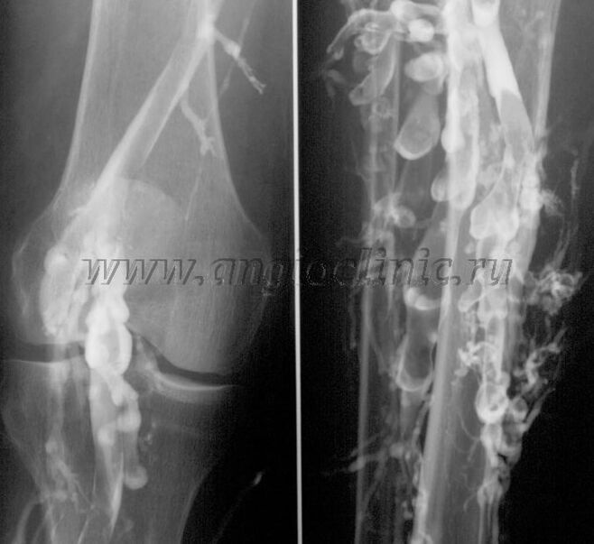 ការស្កេនអ៊ុលត្រាសោន